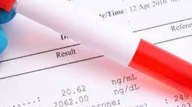 bursa-tup-bebek-tedavisi-oncesi-testler