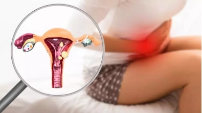 endometriozis-nedir