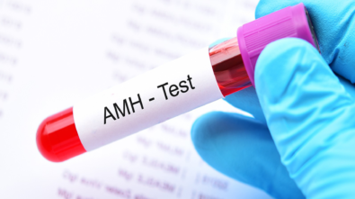 amh testi