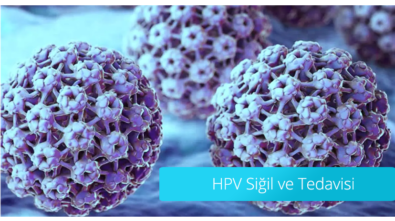 genital-hpv-sigil-ve-tedavisi