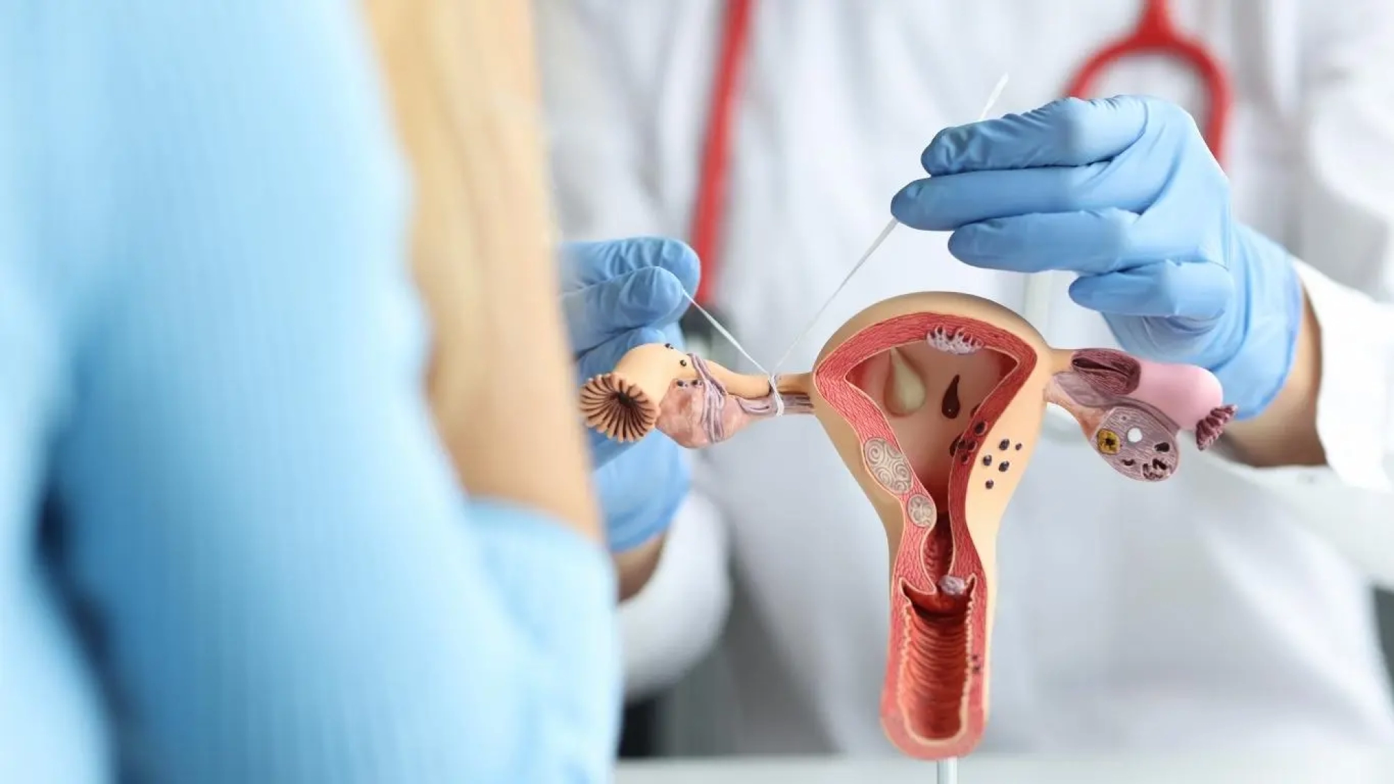 tup-baglatma-ameliyati