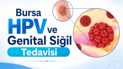 bursa-hpv-ve-genital-sigil-tedavisi