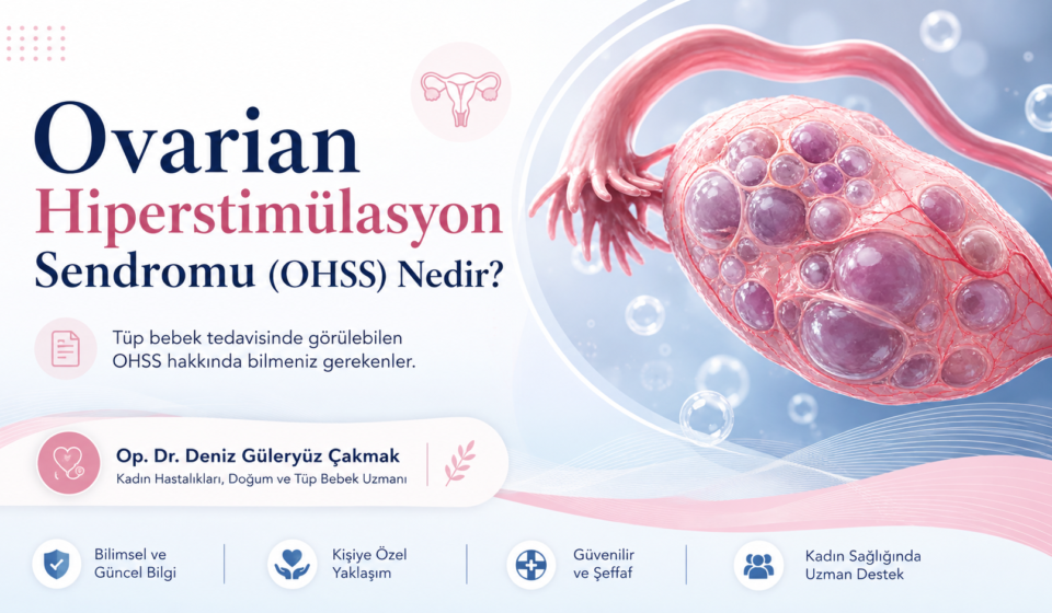 overian-hiperstimulasyon