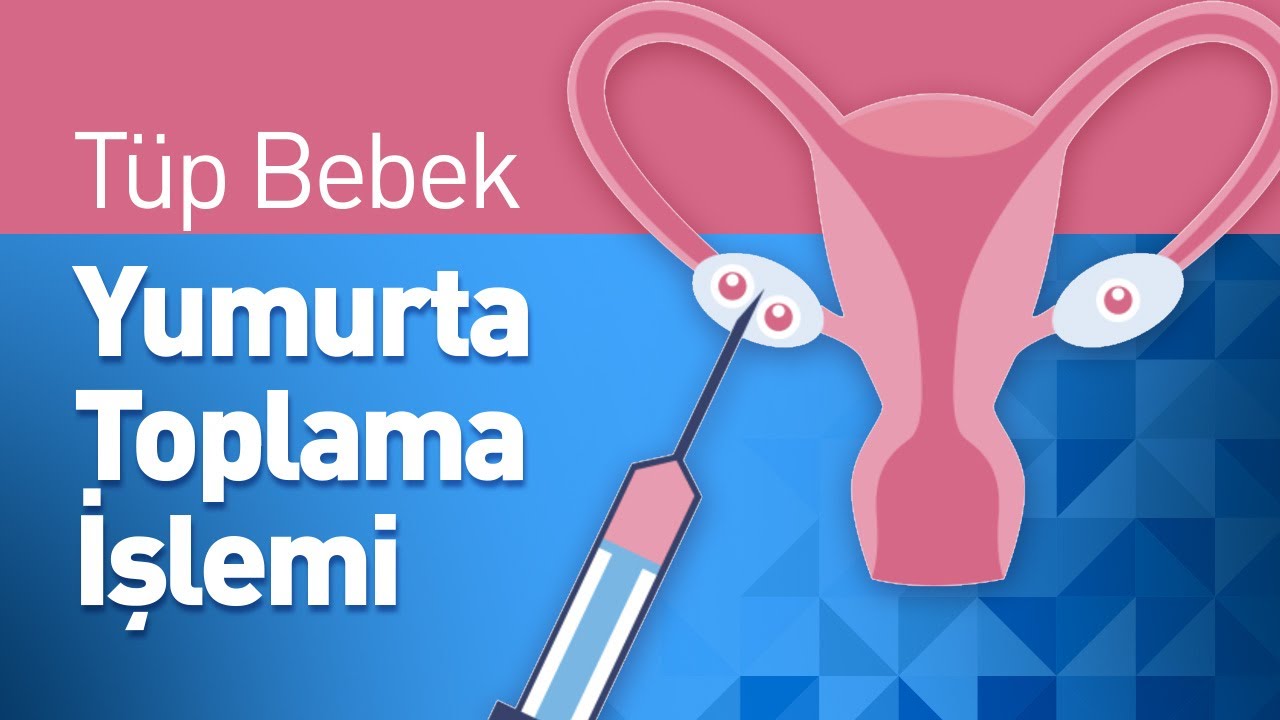 Tüp Bebek Tedavisi: Yumurta Toplama İşlemi