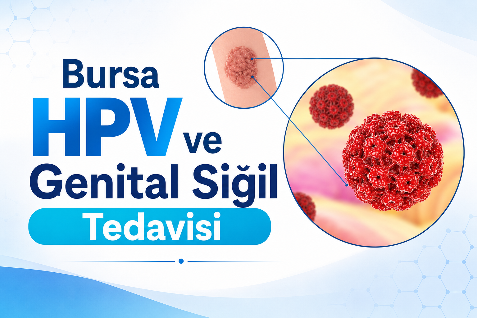 bursa-hpv-ve-genital-sigil-tedavisi