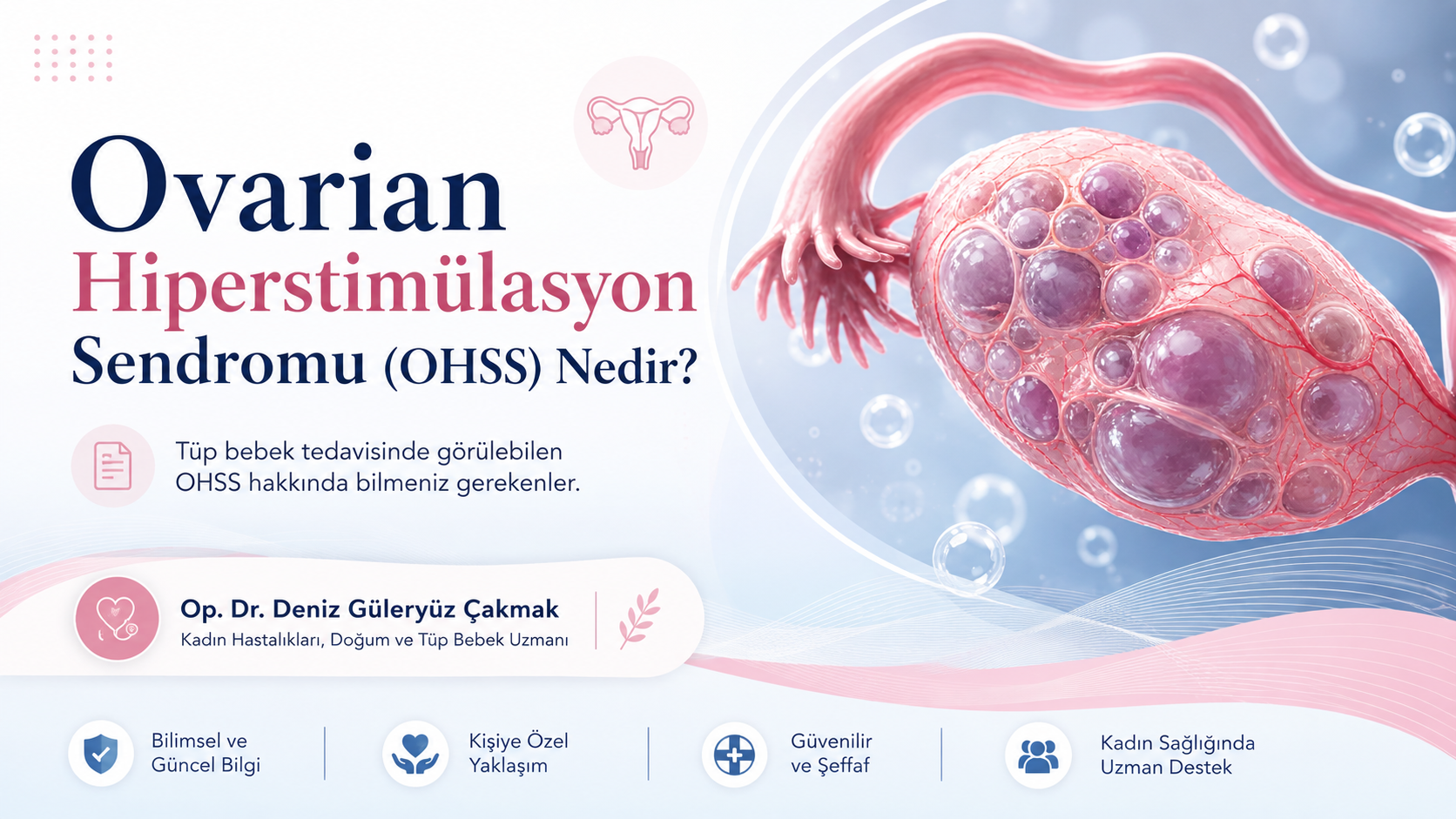 overian-hiperstimulasyon